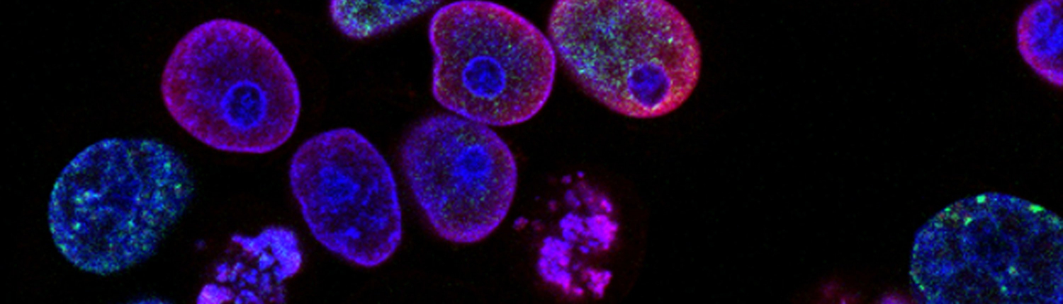 national-cancer-institute-L7en7Lb-Ovc-unsplash_crop